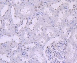 SMARCB1 Recombinant Rabbit Monoclonal Antibody (JB49-18), Invitrogen 100