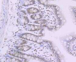 SMARCB1 Recombinant Rabbit Monoclonal Antibody (JB49-18), Invitrogen 100