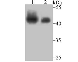 SMARCB1 Recombinant Rabbit Monoclonal Antibody (JB49-18), Invitrogen 100