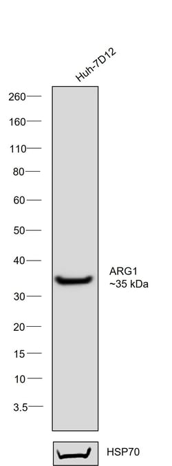 Invitrogen Arginase 1 Recombinant Rabbit Monoclonal Antibody (JB21-49) 100 &mu;L | Buy Online | Invitrogen&trade; | Fisher Scientific
