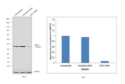 Invitrogen Arginase 1 Recombinant Rabbit Monoclonal Antibody (JB21-49) 100 &mu;L | Buy Online | Invitrogen&trade; | Fisher Scientific