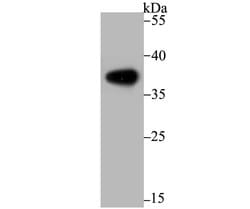 Invitrogen Arginase 1 Recombinant Rabbit Monoclonal Antibody (JB21-49) 100 &mu;L | Buy Online | Invitrogen&trade; | Fisher Scientific