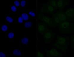 Invitrogen eIF4A3 Recombinant Rabbit Monoclonal Antibody (JG35-33) 100