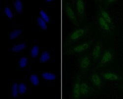 Invitrogen eIF4A3 Recombinant Rabbit Monoclonal Antibody (JG35-33) 100