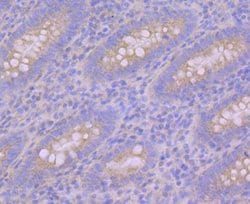 Invitrogen PUM1 Recombinant Rabbit Monoclonal Antibody (JG37-75) 100 &mu;L | Buy Online | Invitrogen&trade; | Fisher Scientific