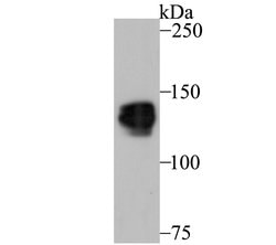 Invitrogen PUM1 Recombinant Rabbit Monoclonal Antibody (JG37-75) 100 &mu;L | Buy Online | Invitrogen&trade; | Fisher Scientific