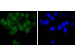 Invitrogen SHP2 Recombinant Rabbit Monoclonal Antibody (SN07-32) 100 &mu;L | Buy Online | Invitrogen&trade; | Fisher Scientific