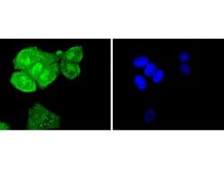 Invitrogen SHP2 Recombinant Rabbit Monoclonal Antibody (SN07-32) 100 &mu;L | Buy Online | Invitrogen&trade; | Fisher Scientific