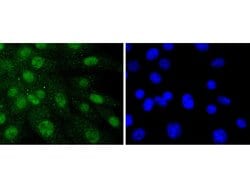 Invitrogen SHP2 Recombinant Rabbit Monoclonal Antibody (SN07-32) 100 &mu;L | Buy Online | Invitrogen&trade; | Fisher Scientific