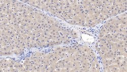 Invitrogen ACVR2A Monoclonal Antibody (C11) 20 &mu;L; Unconjugated:Antibodies,
