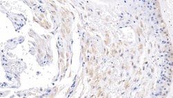 Invitrogen ACVR2A Monoclonal Antibody (C11) 20 &mu;L; Unconjugated:Antibodies,
