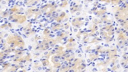 Invitrogen ACVR2A Monoclonal Antibody (C11) 20 &mu;L; Unconjugated:Antibodies,
