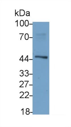 Invitrogen ACVR2A Monoclonal Antibody (C11) 20 &mu;L; Unconjugated:Antibodies,