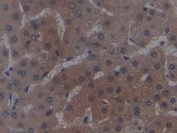 Invitrogen GPT Monoclonal Antibody (C1):Antibodies:Primary Antibodies
