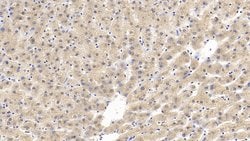 Invitrogen GPT Monoclonal Antibody (C1):Antibodies:Primary Antibodies