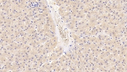Invitrogen GPT Monoclonal Antibody (C1):Antibodies:Primary Antibodies