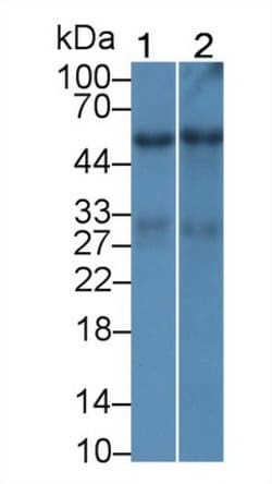 Invitrogen GPT Monoclonal Antibody (C1):Antibodies:Primary Antibodies