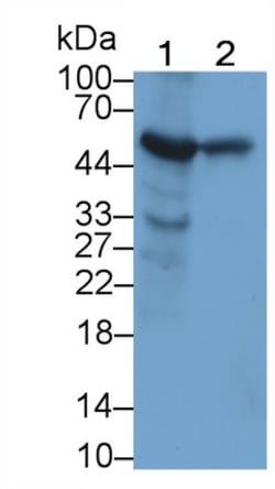 Invitrogen GPT Monoclonal Antibody (C1):Antibodies:Primary Antibodies