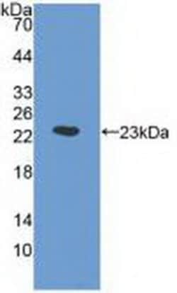 Invitrogen ORM1 Monoclonal Antibody (D6) 20 &mu;L; Unconjugated:Antibodies,