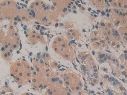Invitrogen Amphiregulin Monoclonal Antibody (A3) 200 &mu;L; Unconjugated:Antibodies,