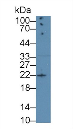 Invitrogen Amphiregulin Monoclonal Antibody (A5) 200 &mu;L; Unconjugated:Antibodies,