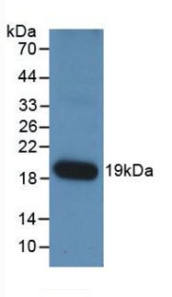 Invitrogen Angiopoietin 1 Monoclonal Antibody (E1) 20 &mu;L | Buy Online | Invitrogen&trade; | Fisher Scientific