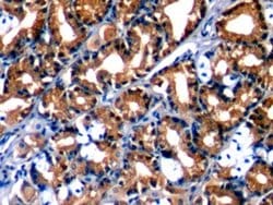 Invitrogen Annexin A1 Monoclonal Antibody (2#):Antibodies:Primary Antibodies