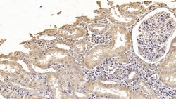 Invitrogen Antithrombin Monoclonal Antibody (C3) 200 &mu;L; Unconjugated:Antibodies,
