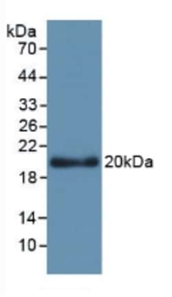 Invitrogen APOL2 Monoclonal Antibody (C1) 200 &mu;L | Buy Online | Invitrogen&trade; | Fisher Scientific