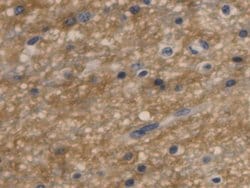 Invitrogen Aquaporin 4 Monoclonal Antibody (C9) 200 &mu;L; Unconjugated:Antibodies,
