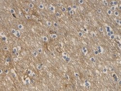 Invitrogen Aquaporin 4 Monoclonal Antibody (C9) 200 &mu;L; Unconjugated:Antibodies,