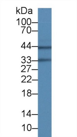 Invitrogen Aquaporin 4 Monoclonal Antibody (C9) 200 &mu;L; Unconjugated:Antibodies,