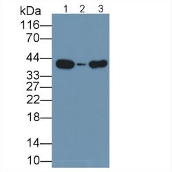 Invitrogen Arginase 2 Monoclonal Antibody (D3):Antibodies:Primary Antibodies