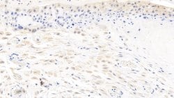 Carbonic Anhydrase IV Monoclonal Antibody (C16), Invitrogen 200 &mu;L;