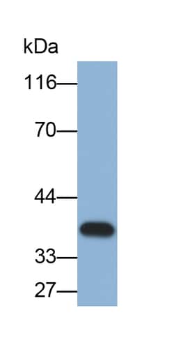 Invitrogen™ Carbonic Anhydrase IV Monoclonal Antibody (7-2-3#)