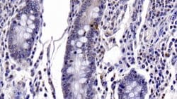 Invitrogen Caspase 6 Monoclonal Antibody (C1):Antibodies:Primary Antibodies