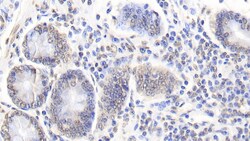 Invitrogen Caspase 6 Monoclonal Antibody (C1) 200 &mu;L; Unconjugated:Antibodies,