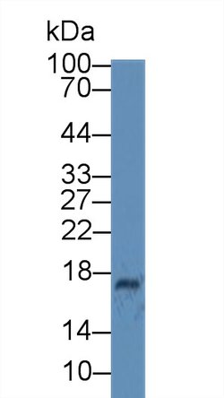 Invitrogen Ceruloplasmin Monoclonal Antibody (C1):Antibodies:Primary Antibodies