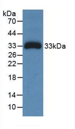 Invitrogen Ceruloplasmin Monoclonal Antibody (C1):Antibodies:Primary Antibodies