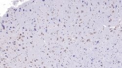 Invitrogen Uteroglobin Monoclonal Antibody (C2):Antibodies:Primary Antibodies