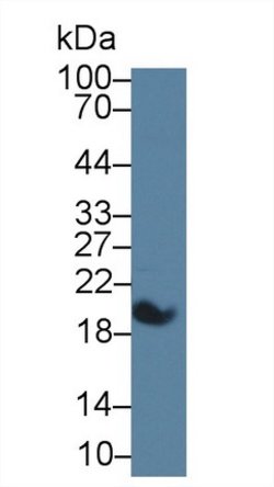 Invitrogen Uteroglobin Monoclonal Antibody (C2):Antibodies:Primary Antibodies