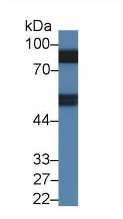 Invitrogen Prothrombin Monoclonal Antibody (C13):Antibodies:Primary Antibodies