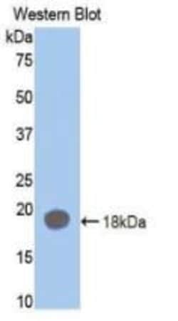 Invitrogen Prothrombin Monoclonal Antibody (C13):Antibodies:Primary Antibodies