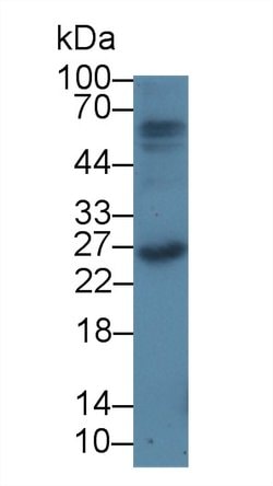 Invitrogen Prothrombin Monoclonal Antibody (C10) 200 &mu;L; Unconjugated:Antibodies,