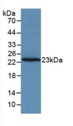 Invitrogen Prothrombin Monoclonal Antibody (C10) 200 &mu;L; Unconjugated:Antibodies,