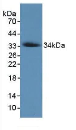 Invitrogen COL7A1 Monoclonal Antibody (C7):Antibodies:Primary Antibodies