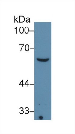 Invitrogen COL8A1 Monoclonal Antibody (C3) 200 &mu;L; Unconjugated:Antibodies,