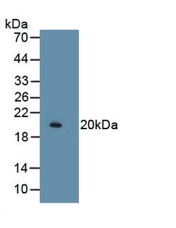 Invitrogen COL8A1 Monoclonal Antibody (C3) 200 &mu;L; Unconjugated:Antibodies,