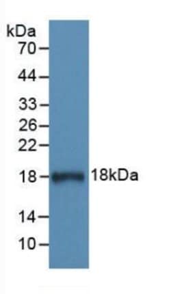 Invitrogen C1 inhibitor Monoclonal Antibody (C2):Antibodies:Primary Antibodies