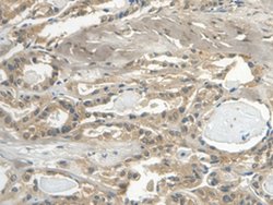 Invitrogen Cystatin C Monoclonal Antibody (C14):Antibodies:Primary Antibodies